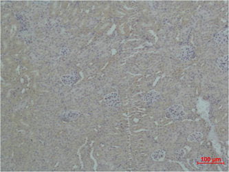 ZBTB45 Antibody