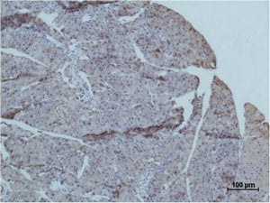 TRIM72 Antibody