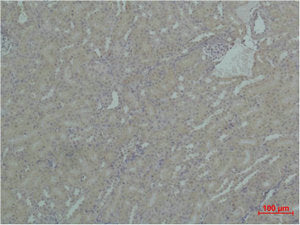 HSP90AA1 Antibody