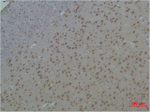 YWHAE Antibody