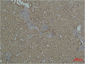 HSPB1 Antibody