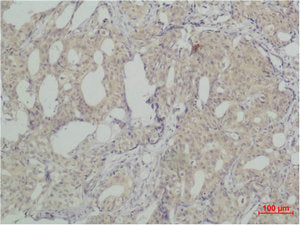 SNAI2 Antibody
