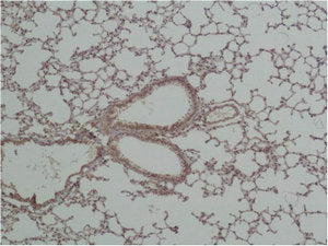 GSK3B Antibody