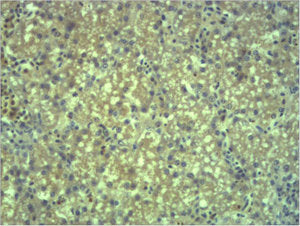 EPG5 Antibody