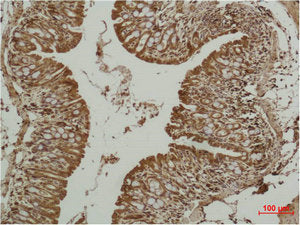 TP53 Antibody
