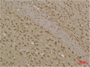MAP1LC3B Antibody