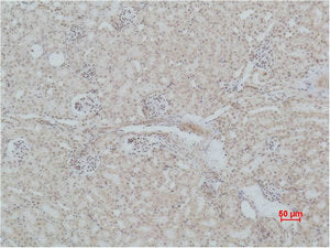MAS1 Antibody