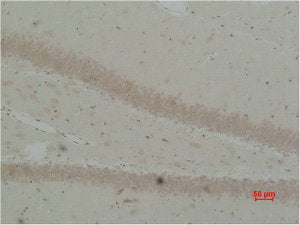 BEST2 Antibody