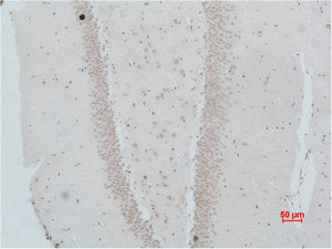 NMBR Antibody