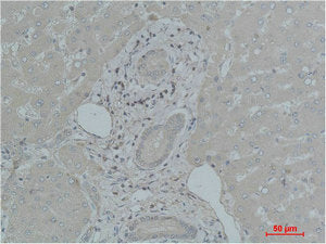 TF Antibody
