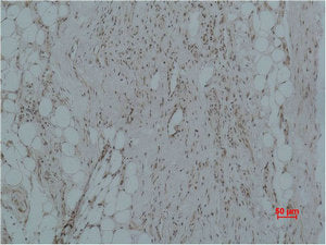 CALHM1 Antibody