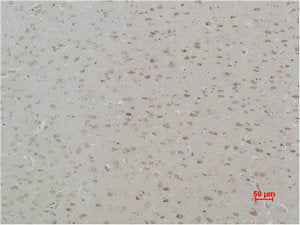 CASR Antibody