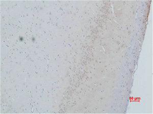 CACNG2 Antibody