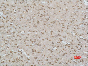 CACNG3 Antibody
