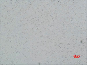 CACNG5 Antibody