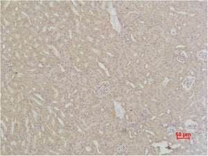 SOD2 Antibody