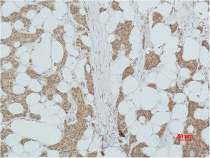 PIK3R1 Antibody