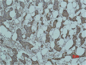 SMAD3 Antibody