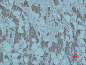 SMAD3 Antibody