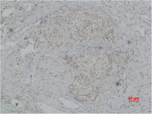 PIK3R2 Antibody