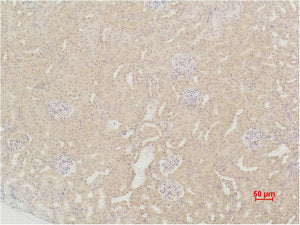 SOD2 Antibody