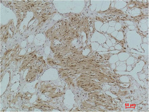 NFKBIA Antibody
