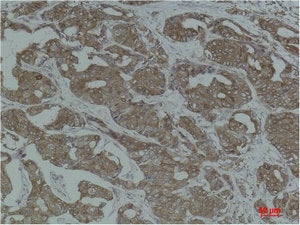 CANX Antibody