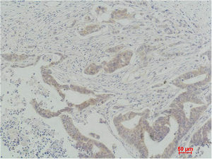 RAF1 Antibody