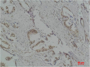 RPS6KB1 Antibody