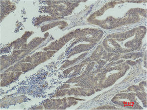 MAP2K1 Antibody