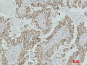 MAP2K2 Antibody