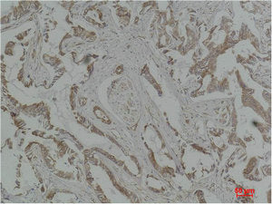 MAP2K5 Antibody