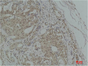 TGFB1 Antibody