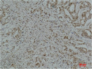 GAPDH Antibody