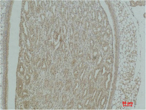 ACTN1 Antibody