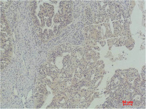 STAT5A Antibody