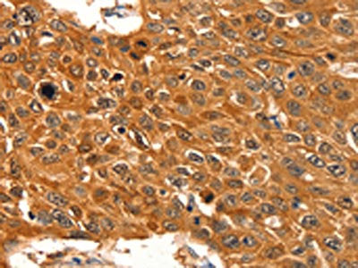 SERPINB5 Antibody