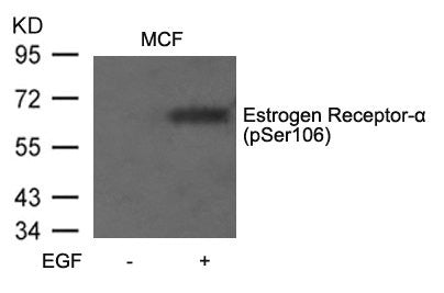 Phospho-ESR1 (Ser106) Antibody