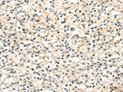 TGM4 Antibody