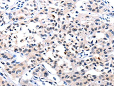 IL18 Antibody