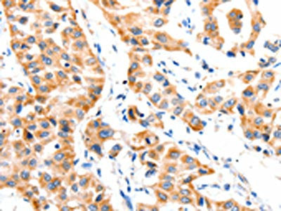 PAFAH1B1 Antibody