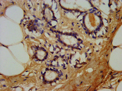 LTBR Antibody