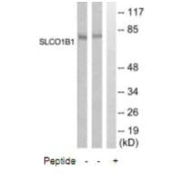 SLCO1B1 Antibody