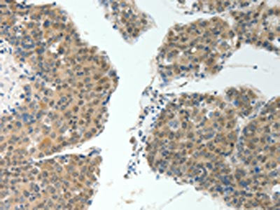ROCK2 Antibody
