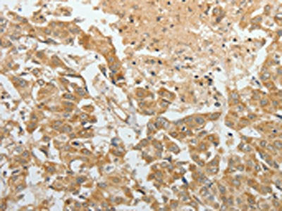 TEKT1 Antibody