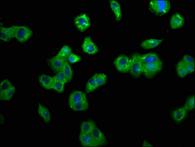 TNFRSF10B Antibody