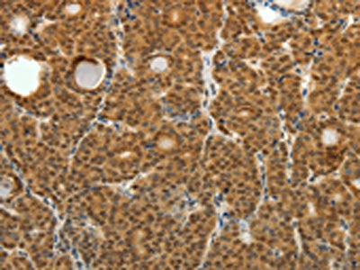 SKP1 Antibody