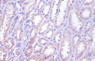TNFRSF10D Antibody