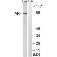 AR (Ab-363) Antibody