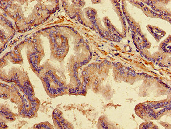 TNFRSF11B Antibody